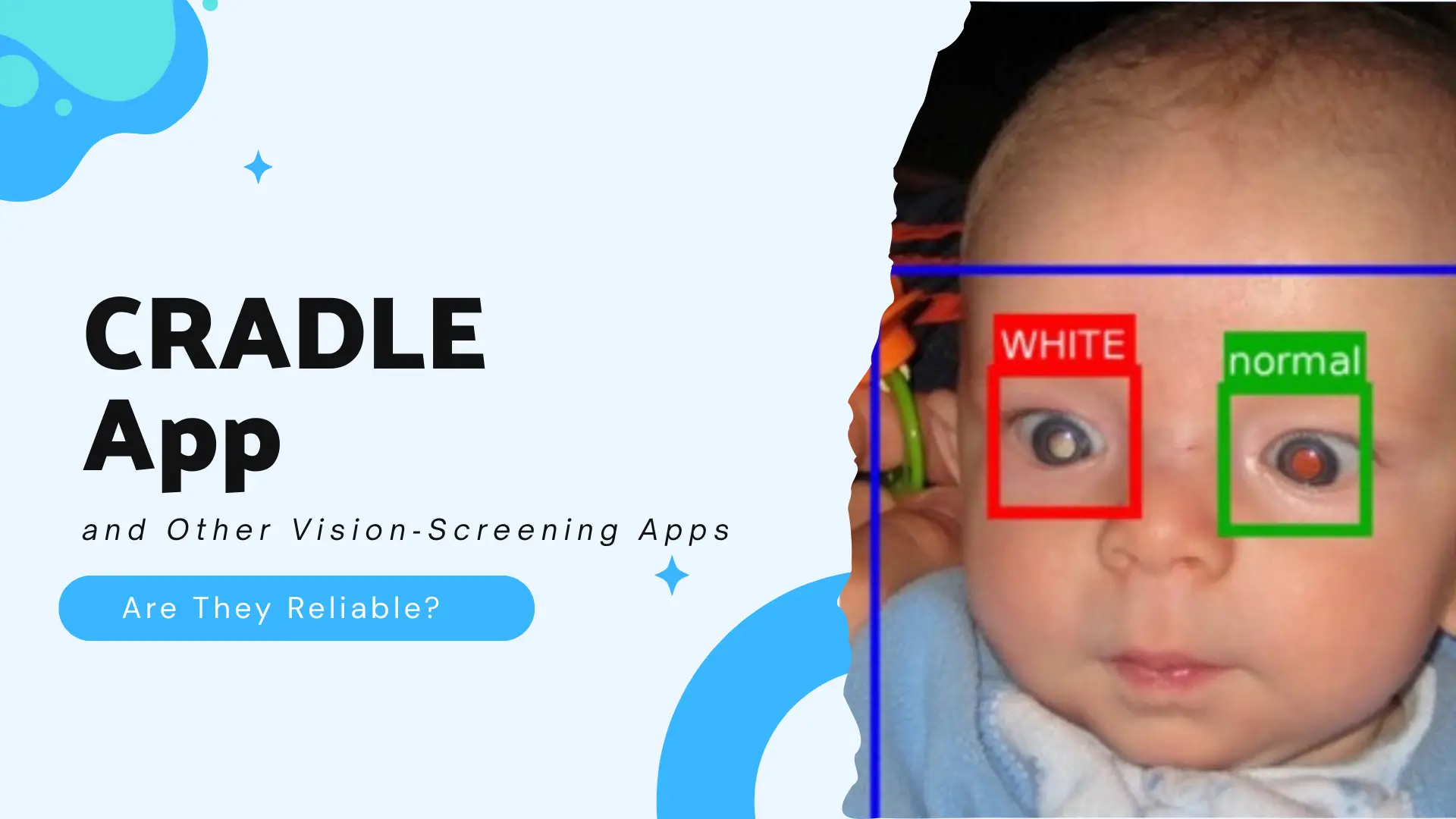 A highly detailed, informative graphic with text and a medical image on a split, stylized background, discussing vision-screening applications. Textual & Graphical Elements (Left Side) The background on the left is a light blue/white gradient with several stylized blue starburst and bubble shapes. In the center-left, large, bold, black text reads: "CRADLE App" on the first line and "and Other Vision-Screening Apps" in smaller, italicized black text below it. Below this text is a light blue rectangular button with rounded corners containing the question in white text: "Are They Reliable?" Image Element (Right Side) The right side features a real-world, clinical photograph of the face of an infant or young baby. The baby has dark hair and is wearing a light blue/white garment. The baby's eyes are open, and there is a visible red reflex (retinoblastoma or a similar condition is often suggested by this kind of photograph). A blue bounding box outlines the baby's entire face. Two smaller, colored bounding boxes focus on the baby's eyes, overlaid with labels: The baby's left eye (viewer's right) is surrounded by a red box with the label "WHITE" in white text on a red background, indicating an abnormal reflex (leukocoria or 'white pupil'). The baby's right eye (viewer's left) is surrounded by a green box with the label "normal" in white text on a green background, indicating a healthy or typical reflex in that eye. This visual demonstrates the core function of an AI or app-based vision screening tool like CRADLE, which analyzes photos for signs of potential eye conditions.