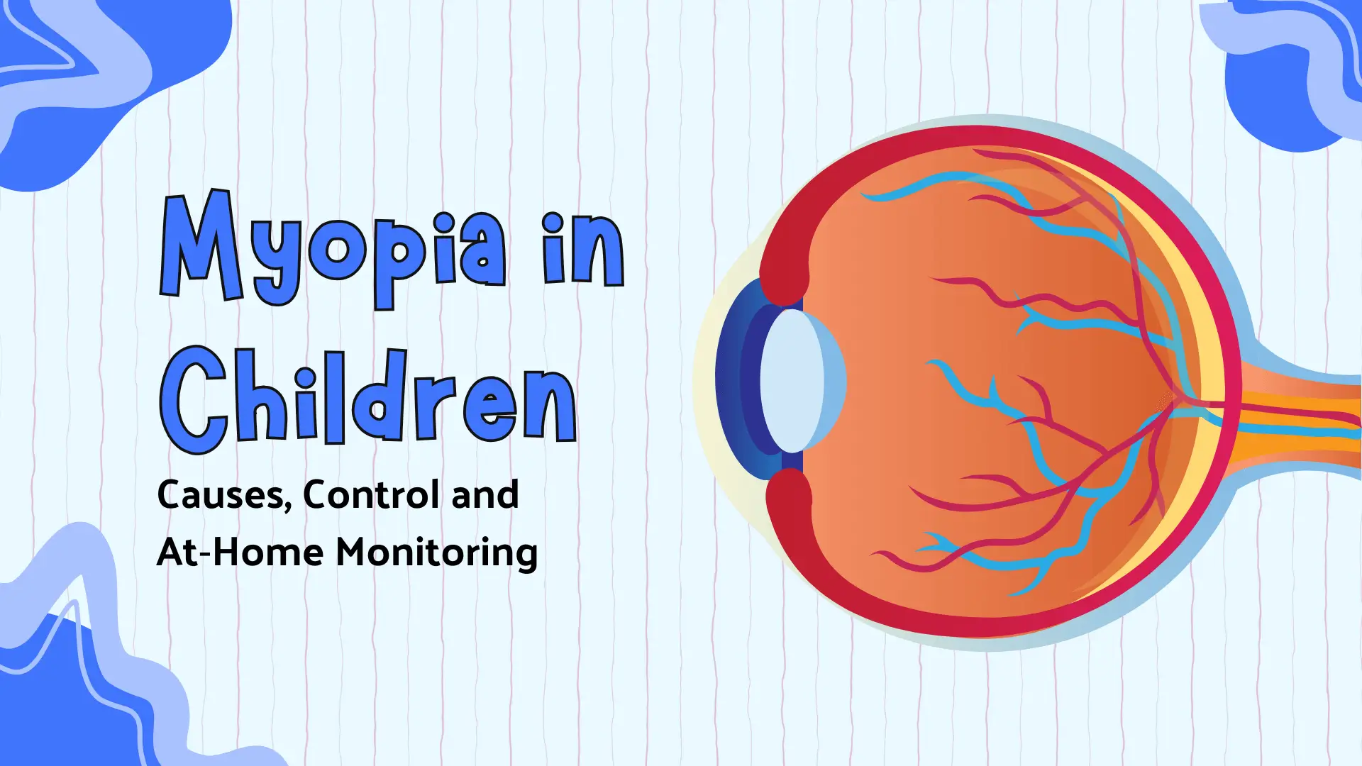 This is a visually appealing title slide for a presentation or informational document about Myopia in Children. Overall Impression: The slide uses a bright, modern, and friendly design with light blue and off-white patterned background elements. The content is divided into a text title on the left and a large, stylized illustration of a human eye on the right. Text Content (Left Side): The main title is stacked and centered on the left half of the slide in a bold, rounded, blue font with a thick light blue/white outline. "Myopia in" "Children" The subtitle is written in a smaller, standard black sans-serif font below the main title: "Causes, Control and At-Home Monitoring" Visual Illustration (Right Side): A large, anatomically stylized, cross-section illustration of the human eyeball dominates the right half. The core body of the eye is rendered in warm tones, primarily orange and reddish-brown, representing the choroid and retina. The outer white layer (sclera) is visible on the far right. The front of the eye (cornea and lens area) is detailed in shades of blue and dark blue, with the lens area depicted in a light yellow/white. Prominent blood vessels (representing the retinal vasculature) are illustrated across the back interior surface of the eye using thin, branching red and light blue lines. The optic nerve extends from the back of the eye towards the right. Background and Design Elements: The background is a very light, almost white, color with subtle light blue diagonal stripe patterns. Abstract, irregular, rounded shapes in solid medium blue are placed in the corners, providing visual anchors. One large blue shape is in the bottom left, and smaller ones are in the top right and bottom right, adding a decorative, fluid frame to the composition. Function: This image functions as the introduction or title graphic for content discussing pediatric nearsightedness (myopia), its etiology, management, and home observation methods.